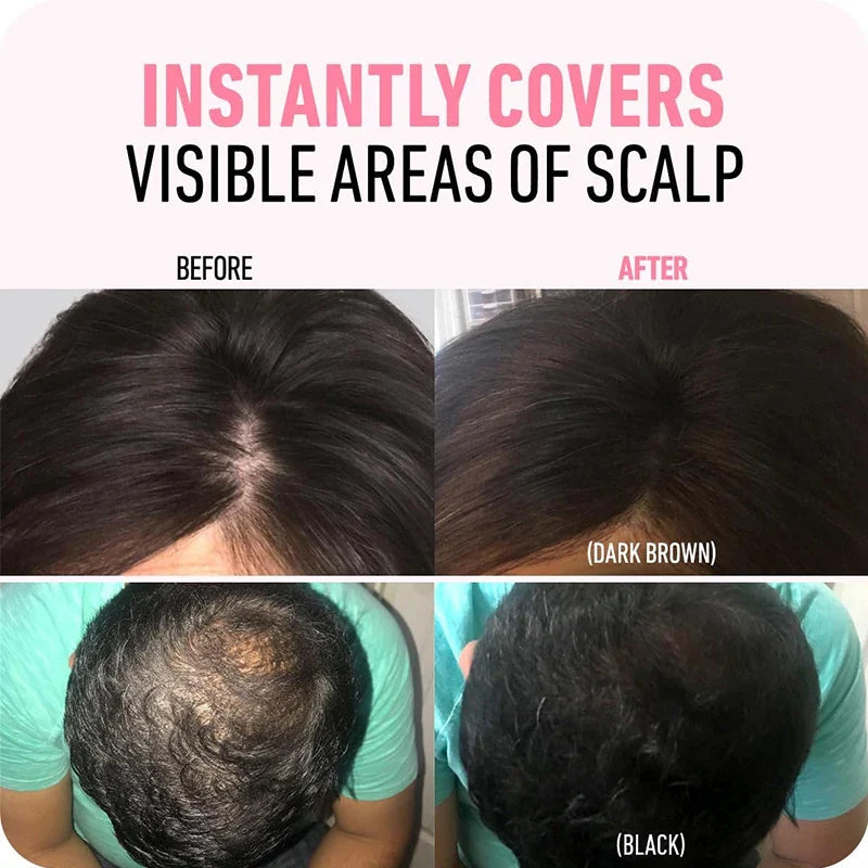 Hairline Powder Instantly Conceals Hair Root Touch Hair Powder for Thinning Hair for Women and Men,Hairline Shadow Powder Makeup